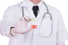 关于尿蛋白的6个误区,你入坑几项?